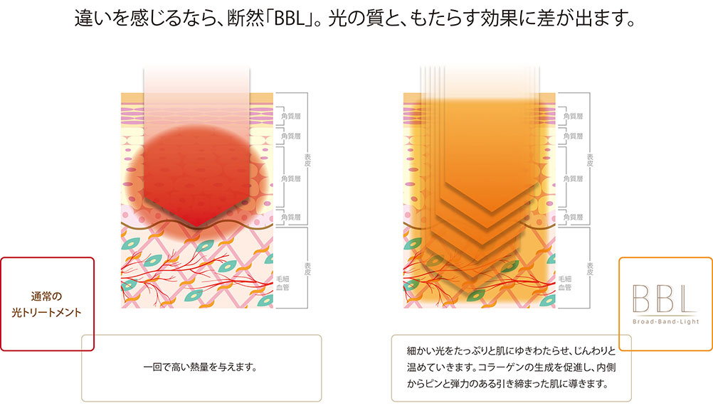 違いを感じるなら、断然「BBL」。光の質と、もたらす効果に差が出ます。